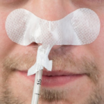 Grip-Lok Large Nasal Gastric Securement Device  100/cs
