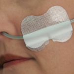 Grip-Lok Nasal Gastric Securement Device  100/cs